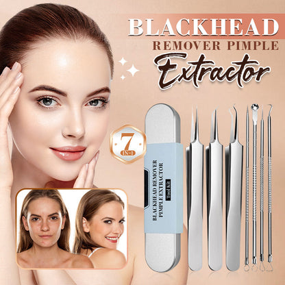 Medical Grade Blackhead Extraction Tool Kit｜Professional Pimple & Blemish Remover Set 🎈✨