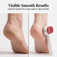 🎁2026 New Arrivals 50% OFF💥Double-Sided Foot Scraper for Callus Removal