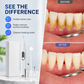 🎁2026 New Arrivals 50% OFF💥Portable Ultrasonic Teeth Cleaner and Tartar Remover Set